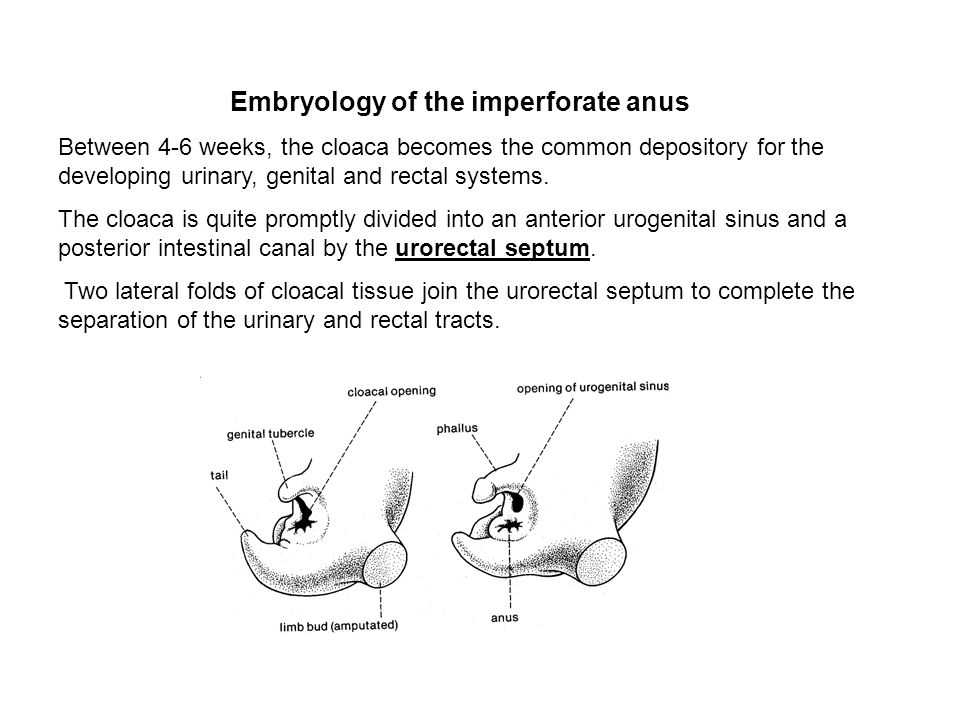 Definition of imperforated anus